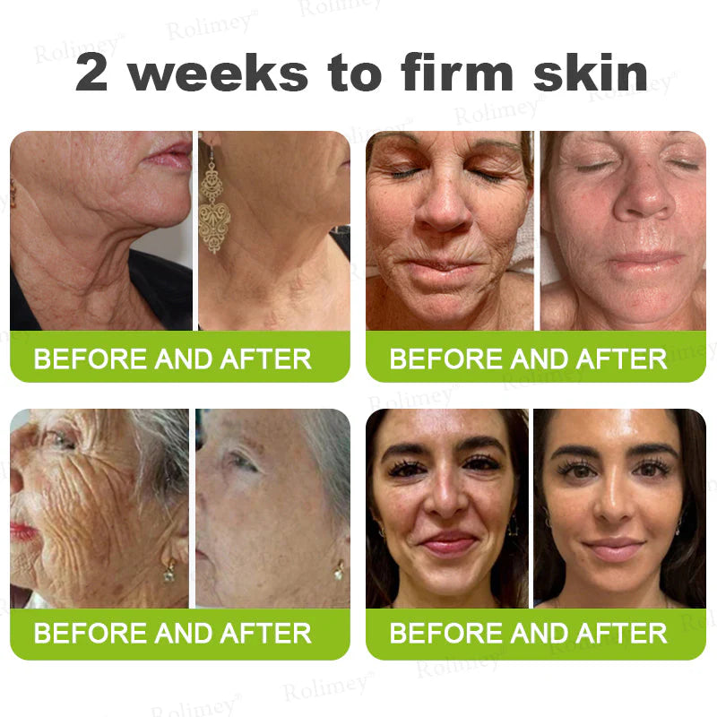 🪄💫Made and shipped from the USA 💫Rolimey® Botox & Vita-A Retinol Shot Wrinkle-Lift Tightening cream - Last Day Promotion 70% OFF