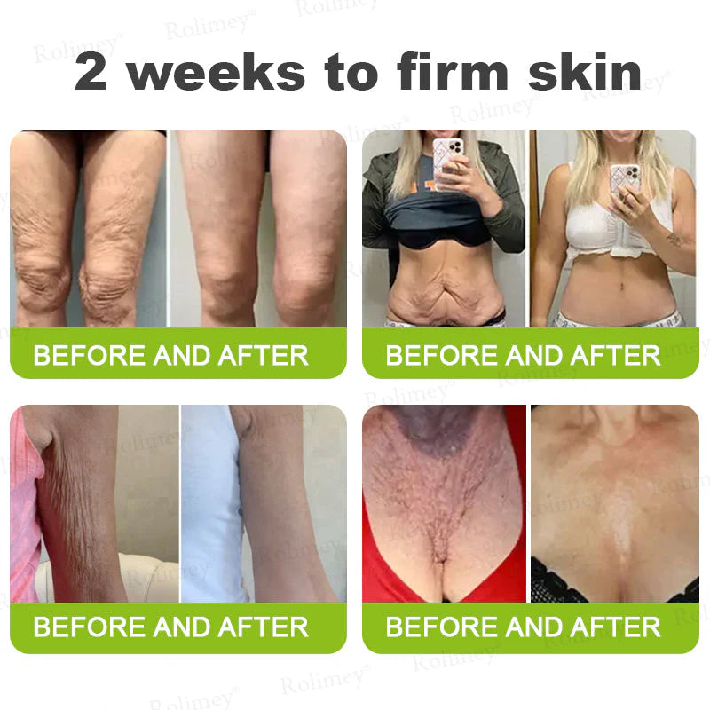 🪄💫Made and shipped from the USA 💫Rolimey® Botox & Vita-A Retinol Shot Wrinkle-Lift Tightening cream - Last Day Promotion 70% OFF