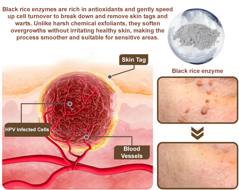Black Rice Skin Repair Cream ⚕️ (Removes warts and tags, relieves psoriasis, evens skin tone and reduces dark spots)