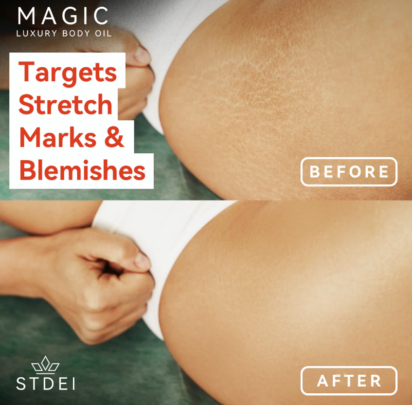 ACEITE CORPORAL MÁGICO DE LUJO - PAGA 1 LEVA 2