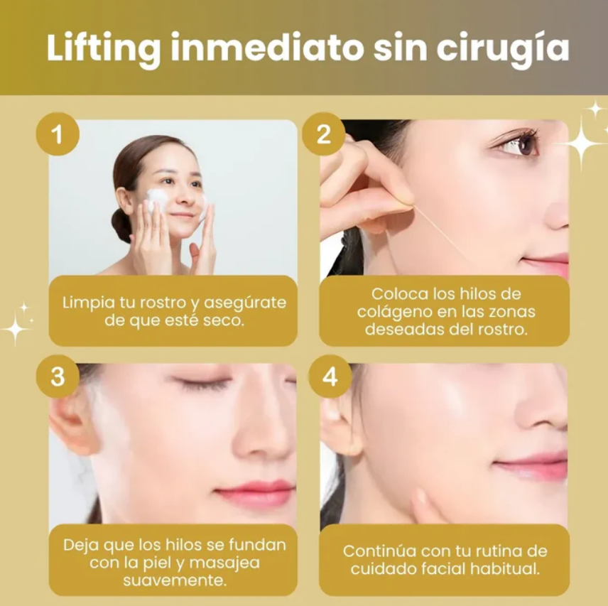 Conjunto de fios de colágeno absorvíveis para lifting + Sérum