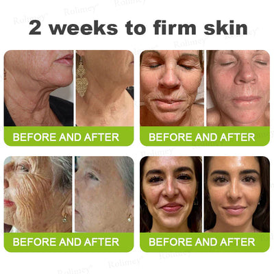 🪄💫Made and shipped from the USA 💫Rolimey® Botox & Vita-A Retinol Shot Wrinkle-Lift Tightening cream - Last Day Promotion 70% OFF