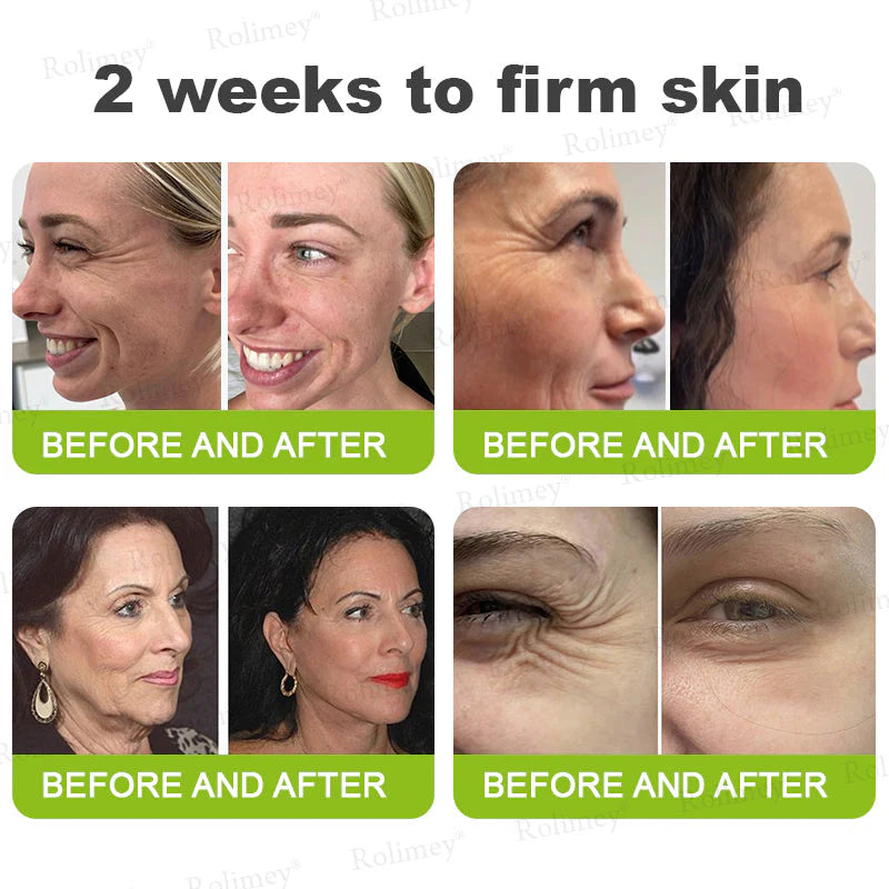 🪄💫Made and shipped from the USA 💫Rolimey® Botox & Vita-A Retinol Shot Wrinkle-Lift Tightening cream - Last Day Promotion 70% OFF