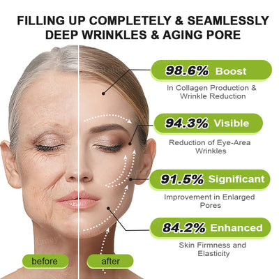 🪄💫Made and shipped from the USA 💫Rolimey® Botox & Vita-A Retinol Shot Wrinkle-Lift Tightening cream - Last Day Promotion 70% OFF