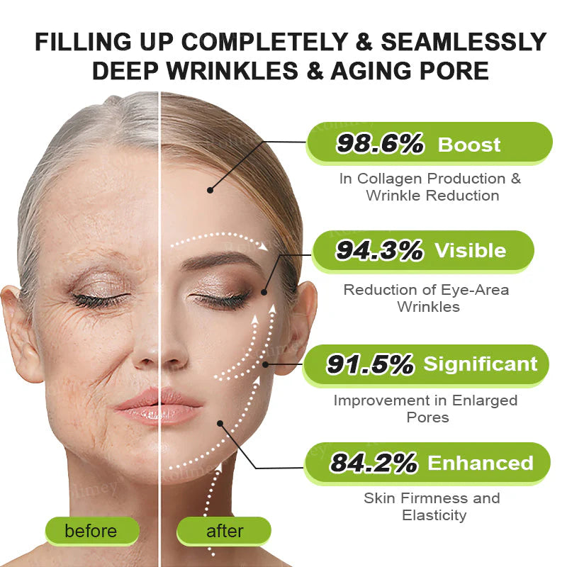 🪄💫Made and shipped from the USA 💫Rolimey® Botox & Vita-A Retinol Shot Wrinkle-Lift Tightening cream - Last Day Promotion 70% OFF