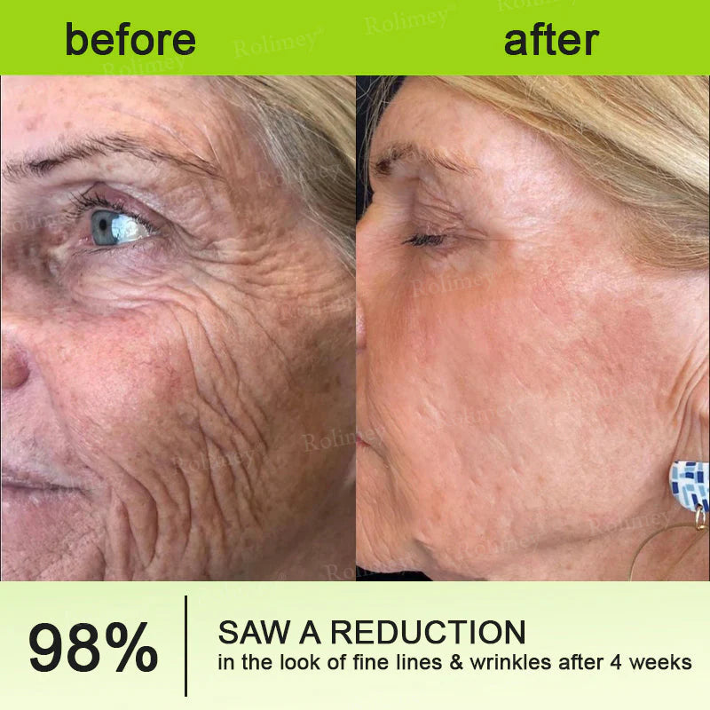 🪄💫Made and shipped from the USA 💫Rolimey® Botox & Vita-A Retinol Shot Wrinkle-Lift Tightening cream - Last Day Promotion 70% OFF