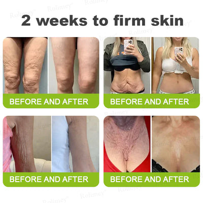 🪄💫Made and shipped from the USA 💫Rolimey® Botox & Vita-A Retinol Shot Wrinkle-Lift Tightening cream - Last Day Promotion 70% OFF
