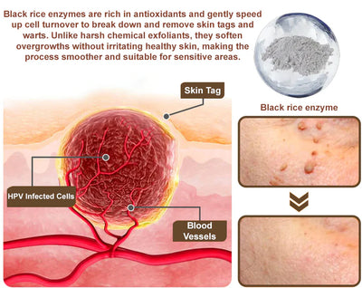 Black Rice Skin Repair Cream ⚕️ (Removes warts and tags, relieves psoriasis, evens skin tone and reduces dark spots)