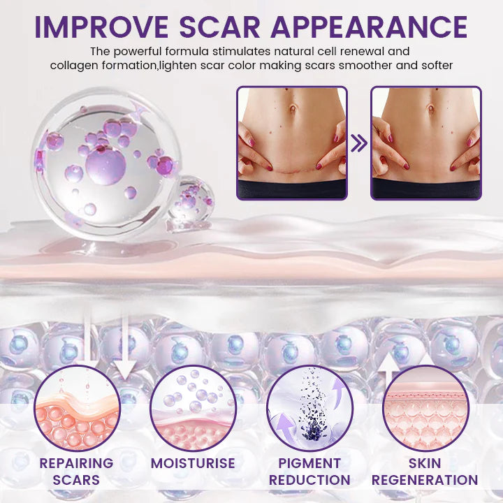 ReGenScar Stem Cell Healing Gel