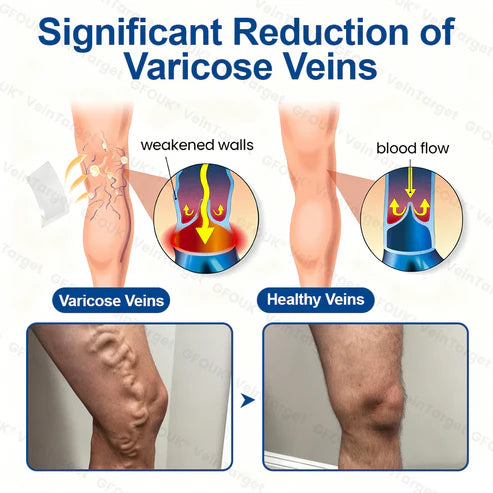 VeinTarget Microneedling Patch