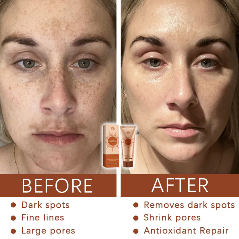 Mascarilla facial despegable Fivfivgo® Herbal Spots