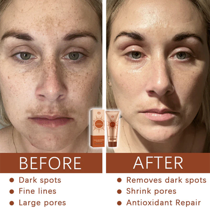 Mascarilla facial despegable Fivfivgo® Herbal Spots