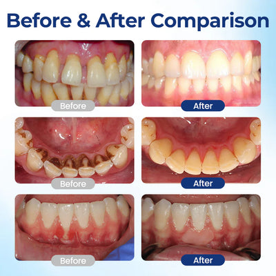 BeeTakt Oral Repair Solution