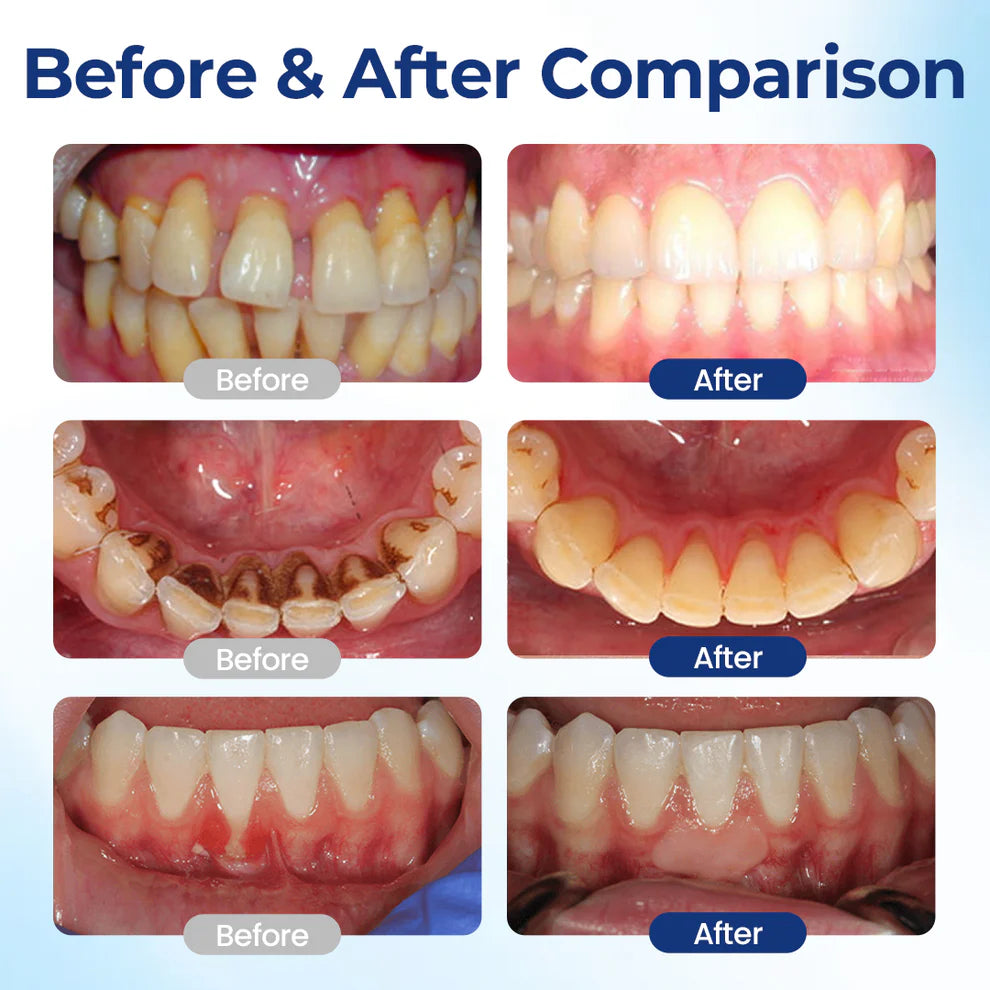 BeeTakt Oral Repair Solution