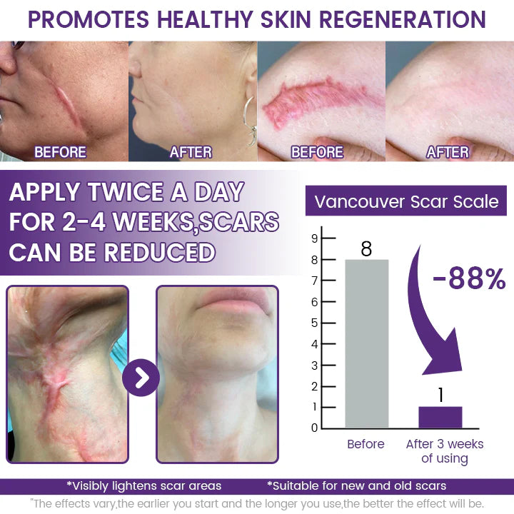 ReGenScar Stem Cell Healing Gel