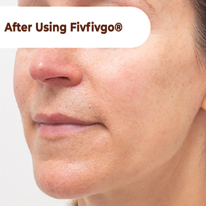 Mascarilla facial despegable Fivfivgo® Herbal Spots