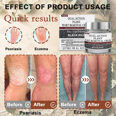Black Rice Skin Repair Cream ⚕️ (Removes warts and tags, relieves psoriasis, evens skin tone and reduces dark spots)