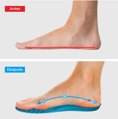 Plantillas ComfyFeet™️ - Disfruta de días sin dolor, sin tratamientos caros ni visitas al médico...