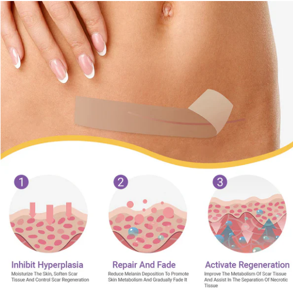 ✅Tienda oficial | Ourlyard® Cinta reparadora de nanoagujas de ácido hialurónico
