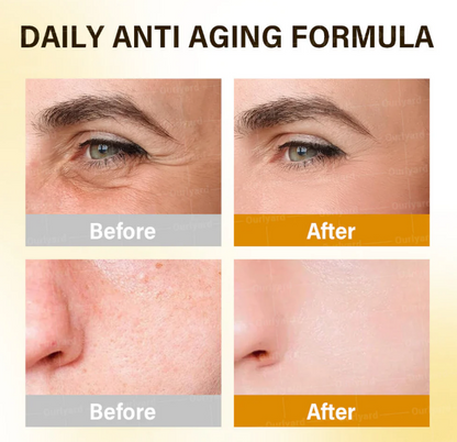 Rolimey® Crema hidratante antienvejecimiento con ácido hialurónico, retinol y colágeno – para rostro, cuello, escote y piernas – Fabricada en el Reino Unido – Uso diurno y nocturno